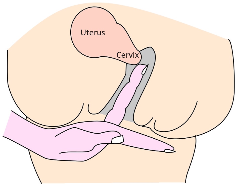 carlos curbelo recommends hitting the cervix pic