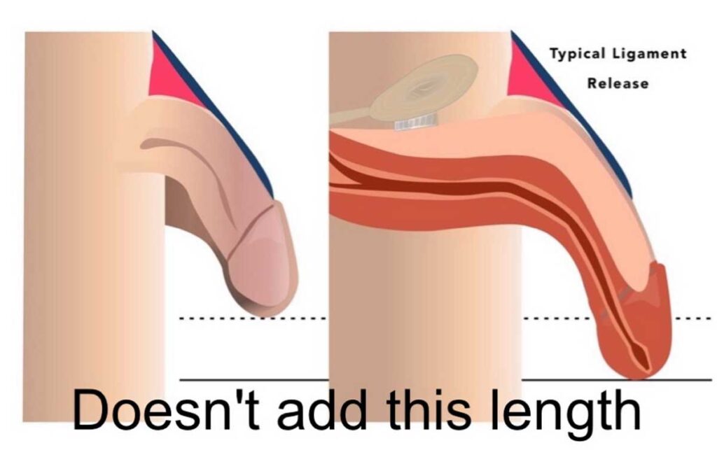 does masturbation make your penis bigger