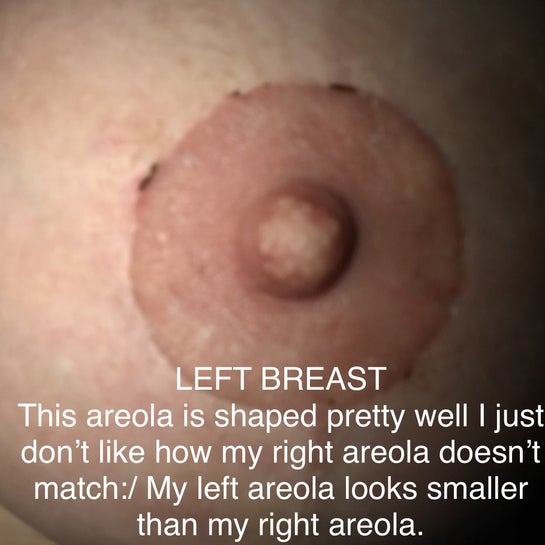 adam moede share are big areolas normal photos