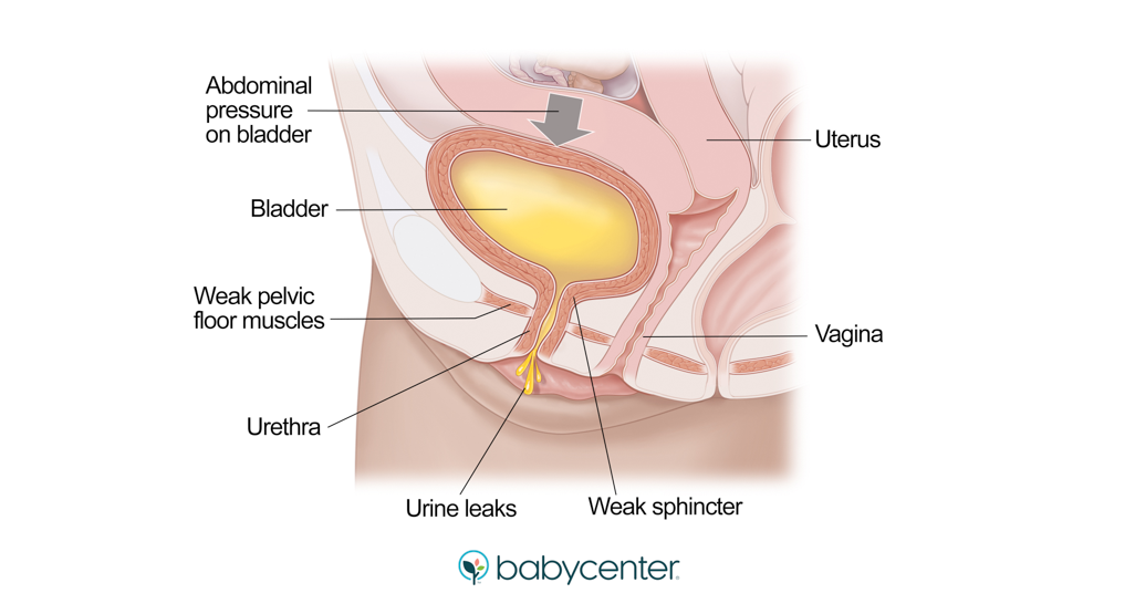 andrew bigelow recommends Pregnant Piss Pics