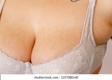 Best of Tits with stretch marks