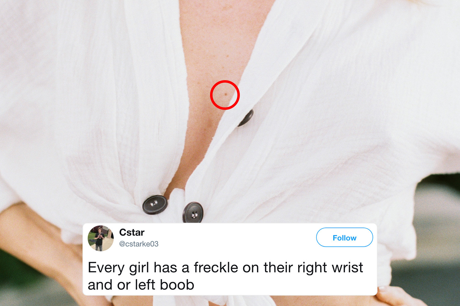 ayesha avila recommends freckles on boobs pic