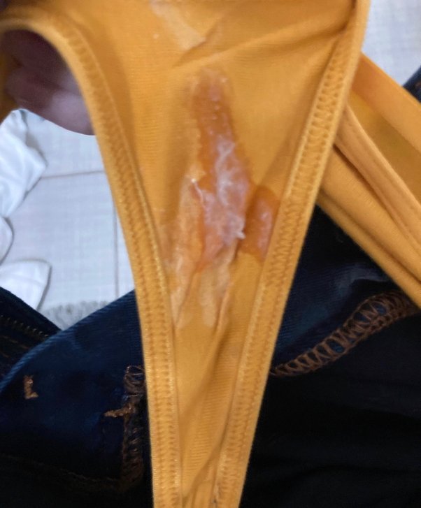 brett malm recommends poop stains in panties pic