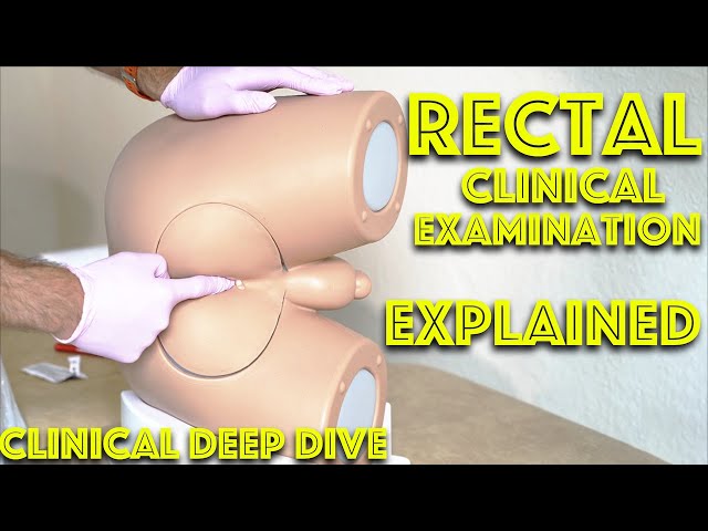 connor wing recommends female rectal exams video pic