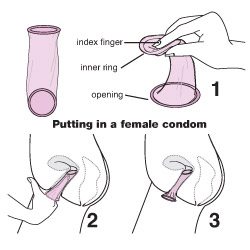 Female Condom In Use Pictures of anyone