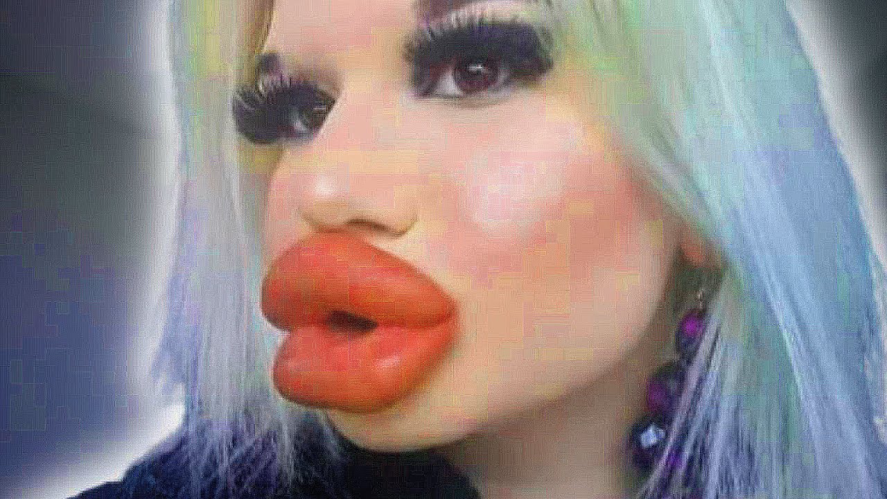 aaron hepner add photo youtuber with big lips