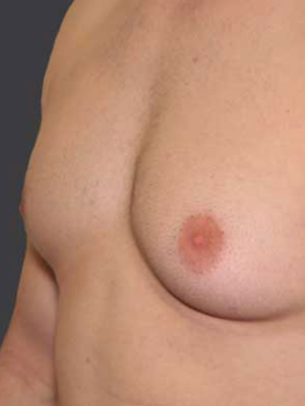 Best of Enormous nipples pics