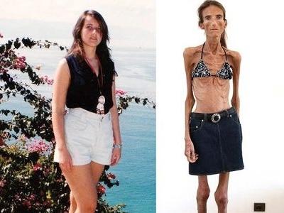 carol townsley recommends the skinniest girl ever pic