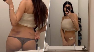 Best of Does mia khalifa have fake boobs