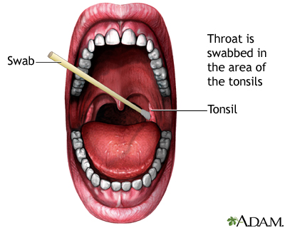 andrea ujvari recommends Sore Throat From Deep Throat