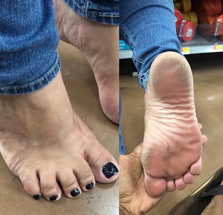 carlo micalizio add sexy bbw feet photo