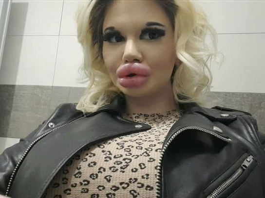 david affinito recommends big lips suck pic