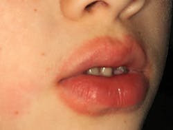 ainsley welch add lips made for sucking photo