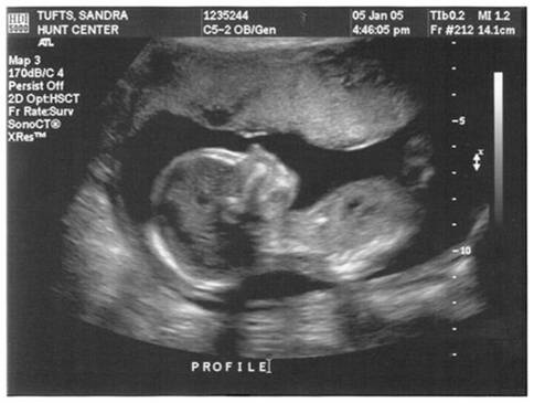 fake ultrasound online free