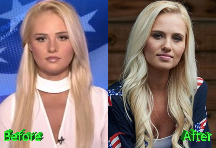 camile haughton recommends tomi lahren fake boobs pic