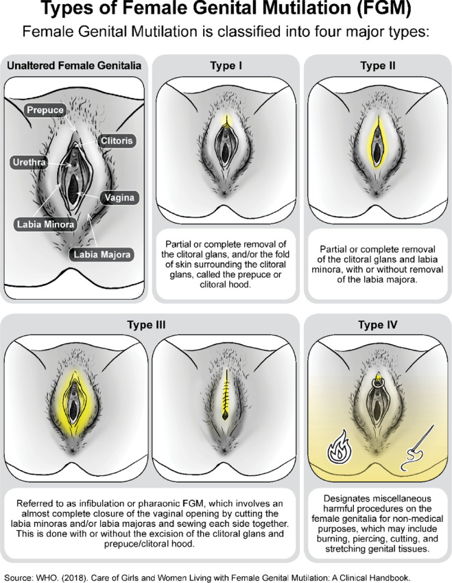 Best of Large labial folds