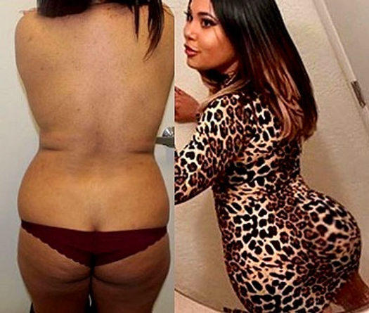 casey burdette recommends Pornstars With Butt Implants