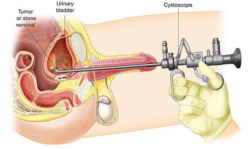 bruce kranz recommends real prostate exam video pic