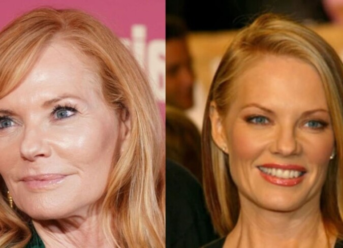 cyril dayupay recommends did marg helgenberger have a stroke pic