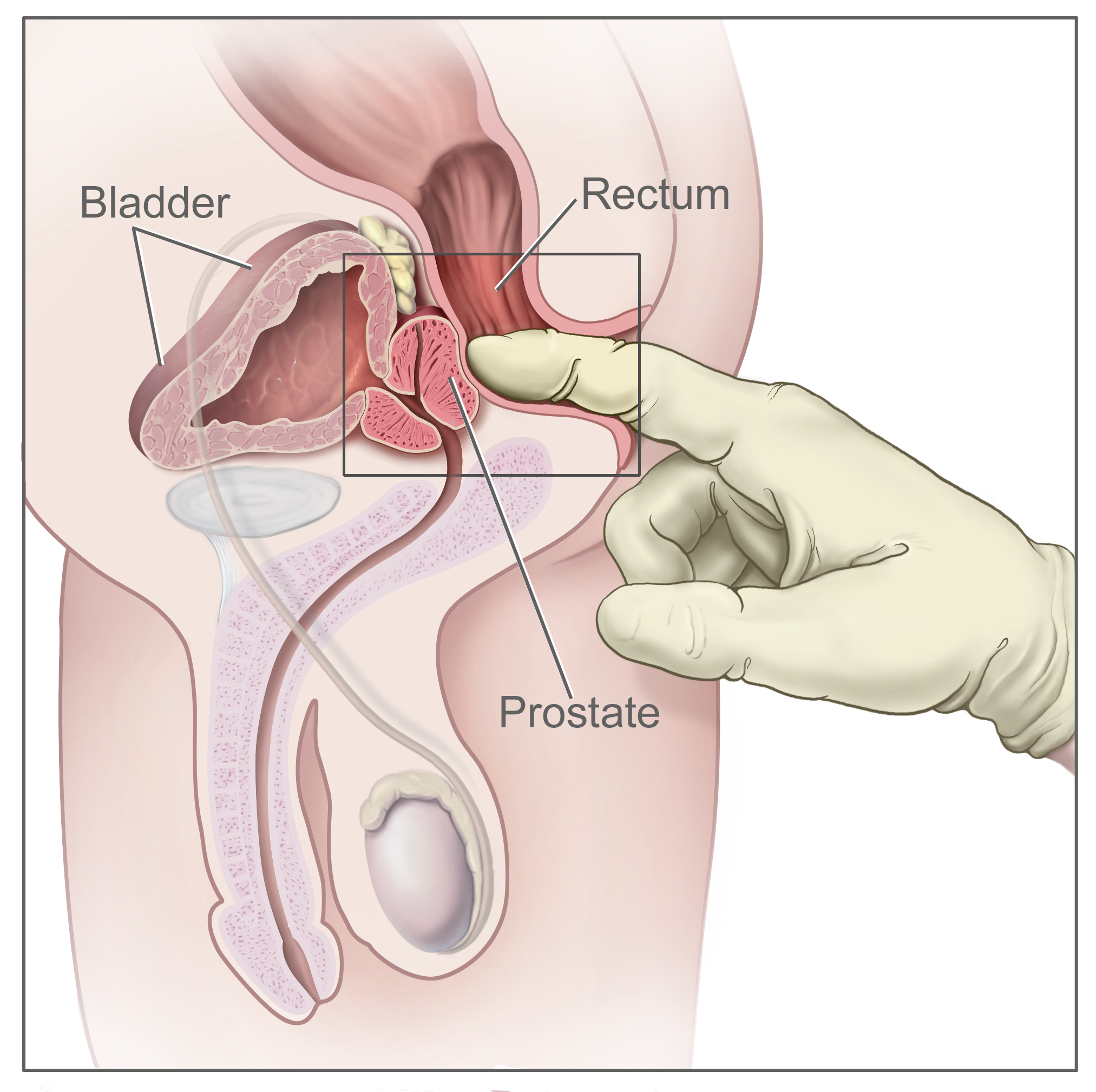 amanda weiterman add real prostate exam video photo