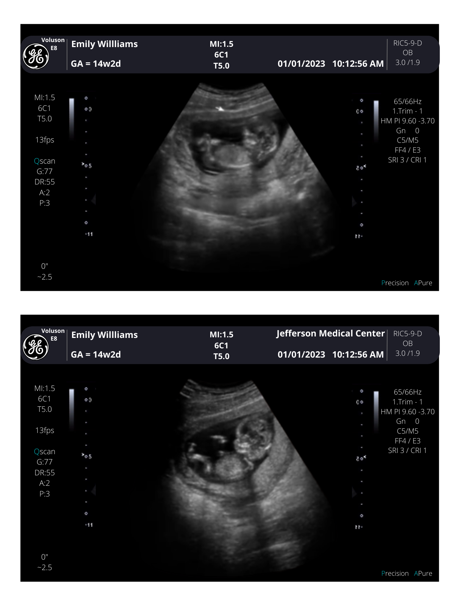 bob eckhardt recommends fake ultrasound online free pic