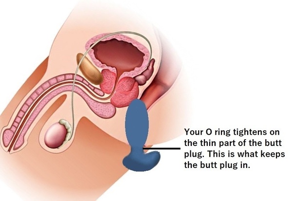 aline mrad recommends When Anal Goes Wrong