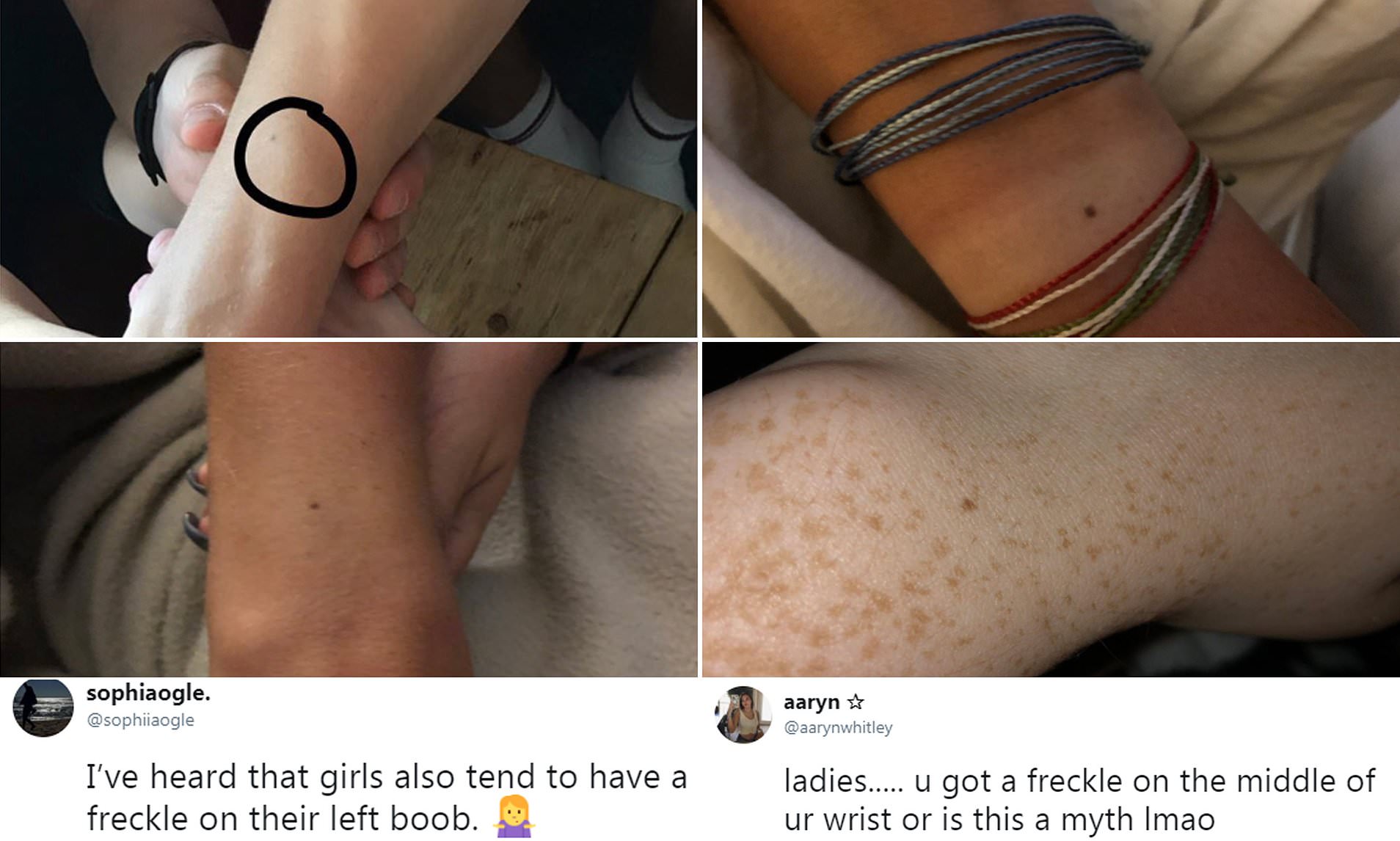 angela voysey recommends freckles on boobs pic