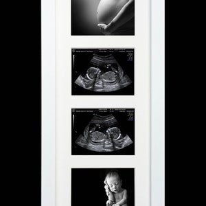 aamar mahmood share fake ultrasound online free photos