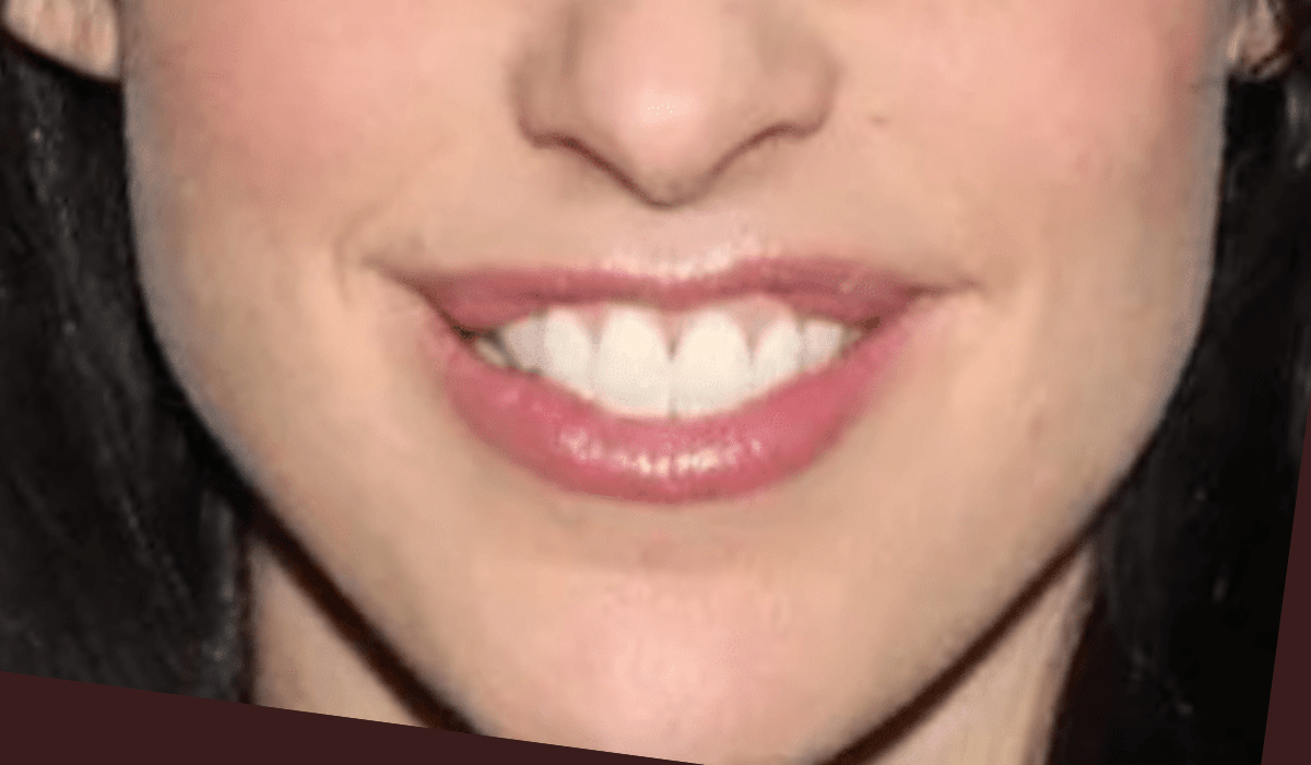 Catherine Reitman Lips cunt pictures