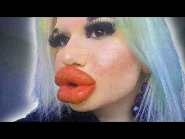 dawson john recommends Youtuber With Big Lips