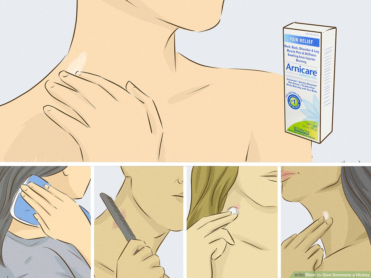 donna tapfield recommends How To Give Someone A Hickey