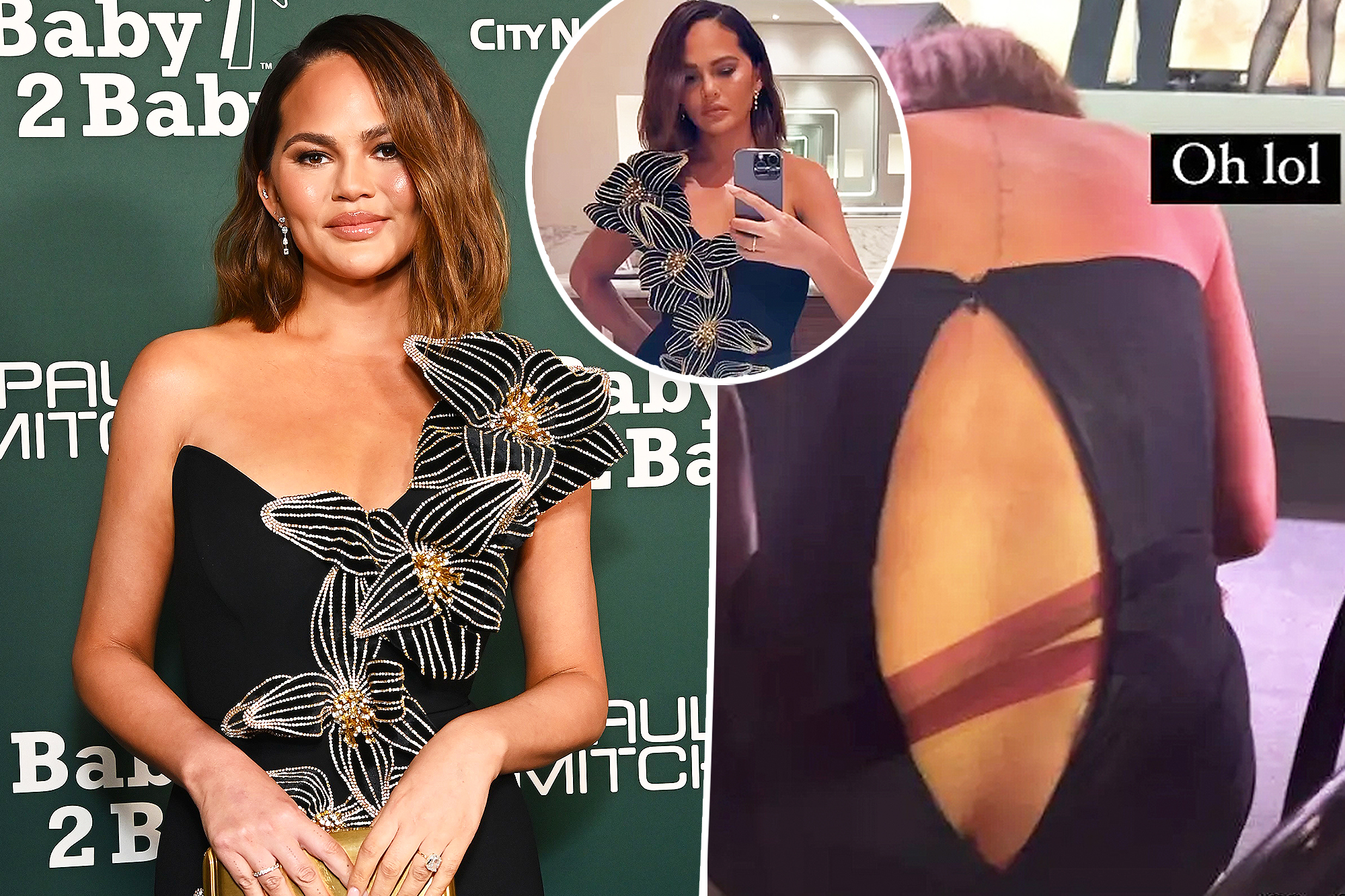 dairelis drago share chrissy teigen dress malfunction uncensored photos