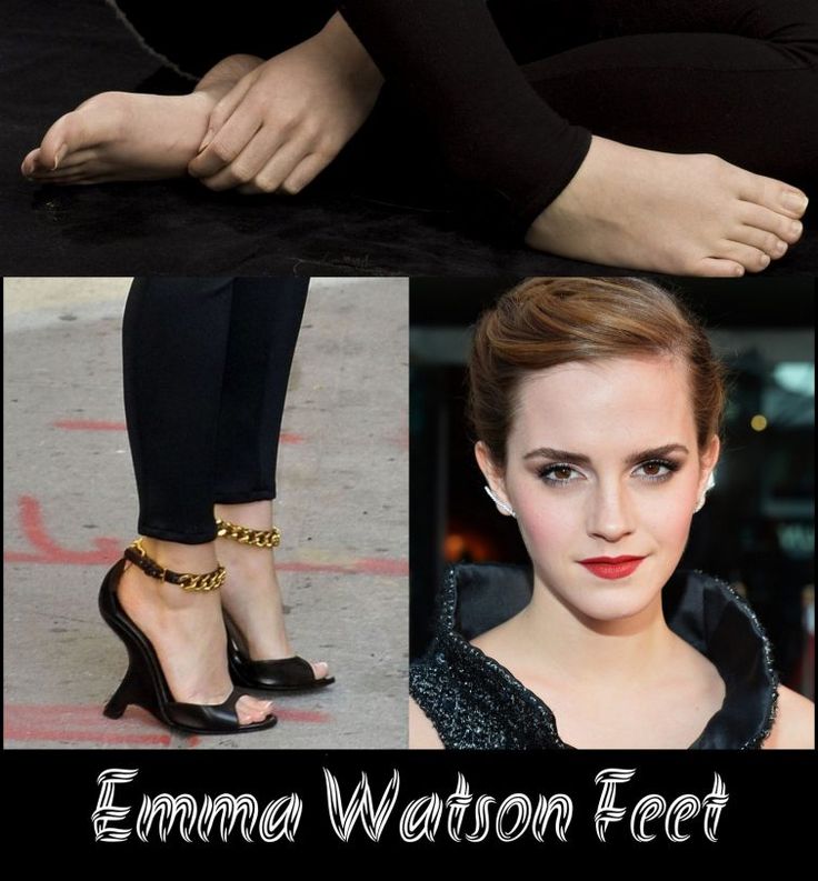 bridgette hicks recommends Emma Watson Legs And Feet