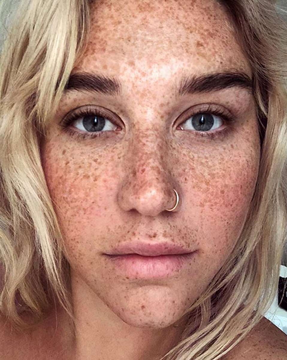 dedric carter recommends hot chicks with freckles pic