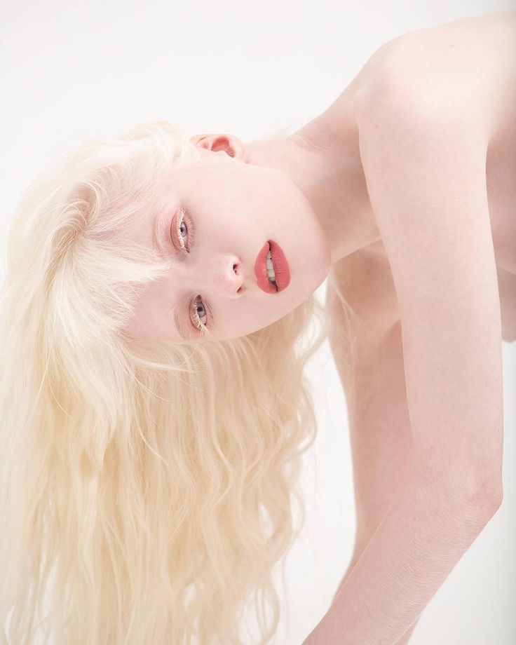 cristina osuna recommends albino girl nude pic