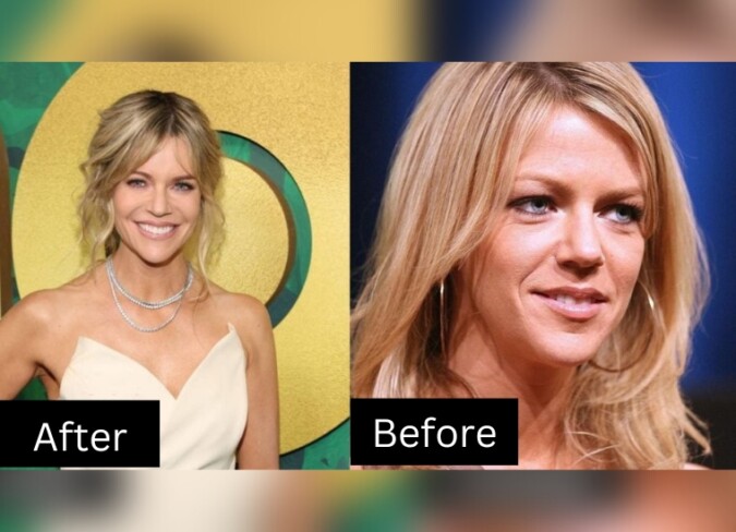 caroline wicht recommends kaitlin olson boob job pic