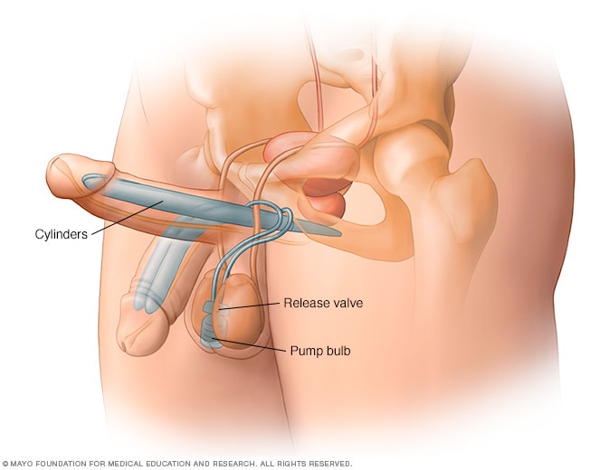 dj schwartz recommends boner during physical exam pic