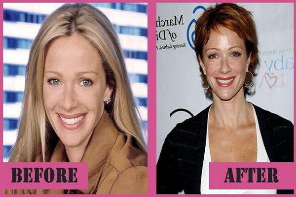 ali habeeb recommends Lauren Holly Breast Implants