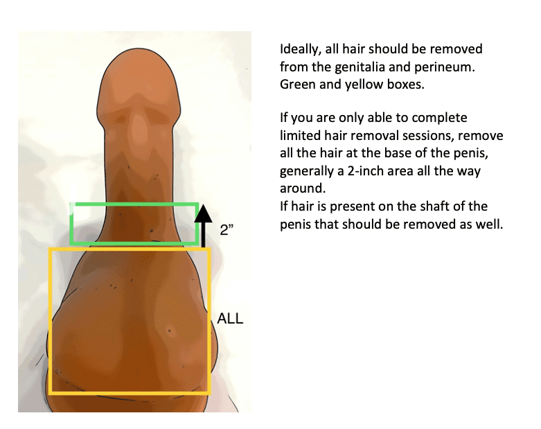 brandon kress recommends how to remove hair from penis pic