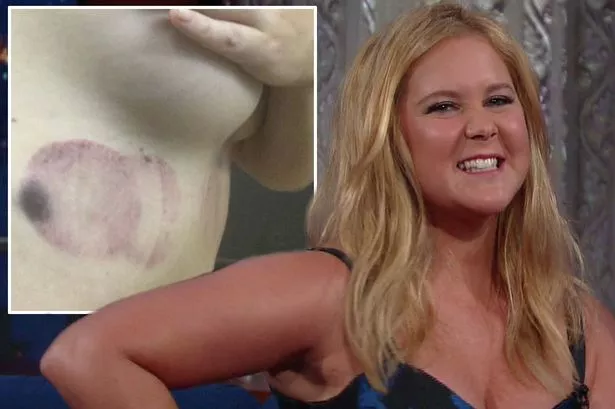 cliff simpson recommends Amy Schumer Tit Pic