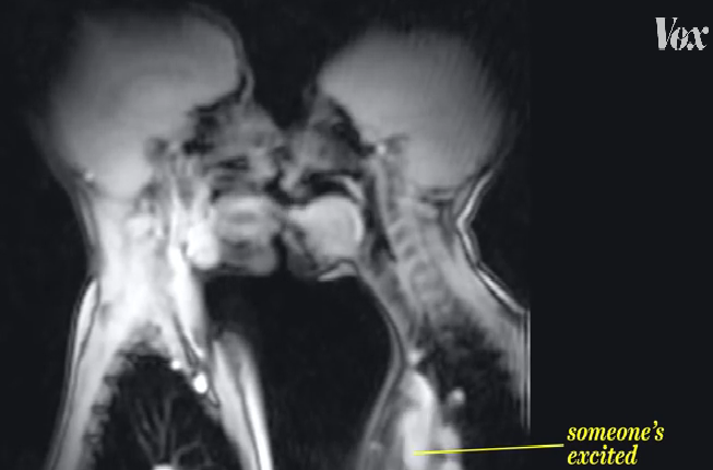 x rays of people having sex