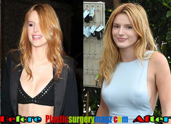 deborah roose recommends bella thorne boob job pic