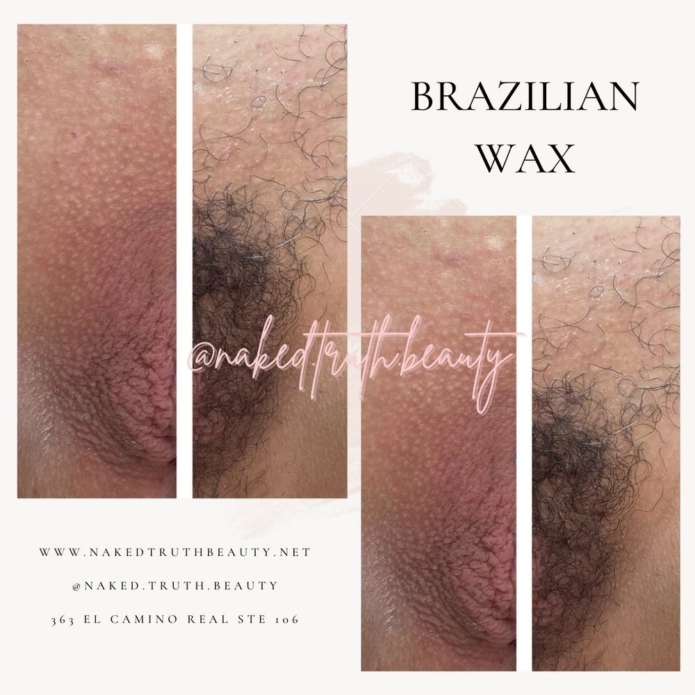 borger breeveld recommends brazilian wax before and after pictures pic