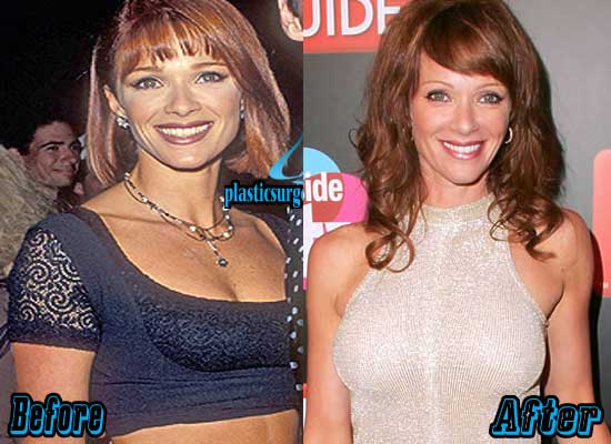 dexter labasan recommends Lauren Holly Breast Implants