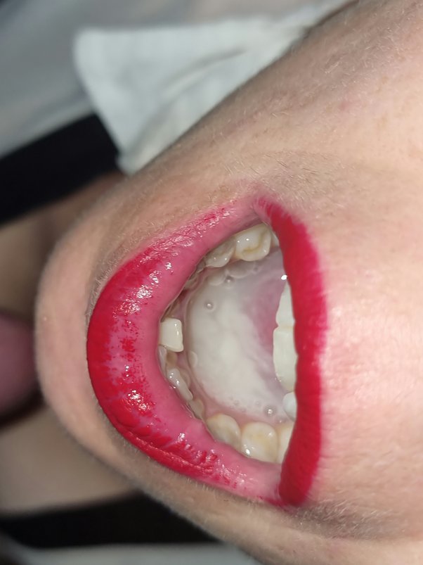 Cum Running Out Of Mouth woll xxx