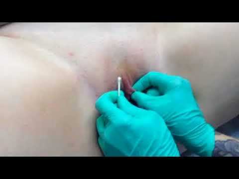 daylinda lopez recommends clitoral hood piercing video pic