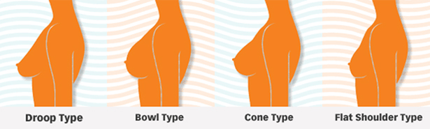 Cone Shaped Tits con enanas