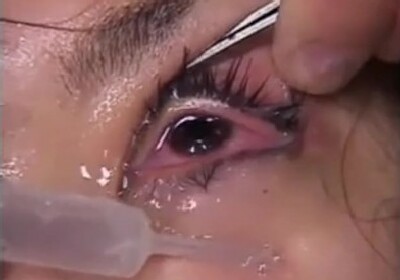 becky coen recommends cum in eye pic