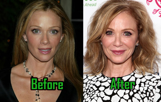 barbara shears recommends Lauren Holly Breast Implants