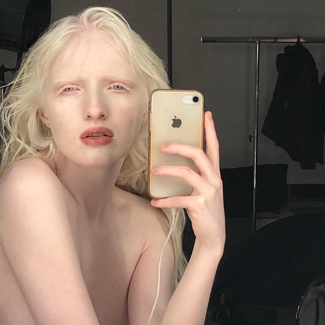 crystal glover recommends Albino Girl Nude